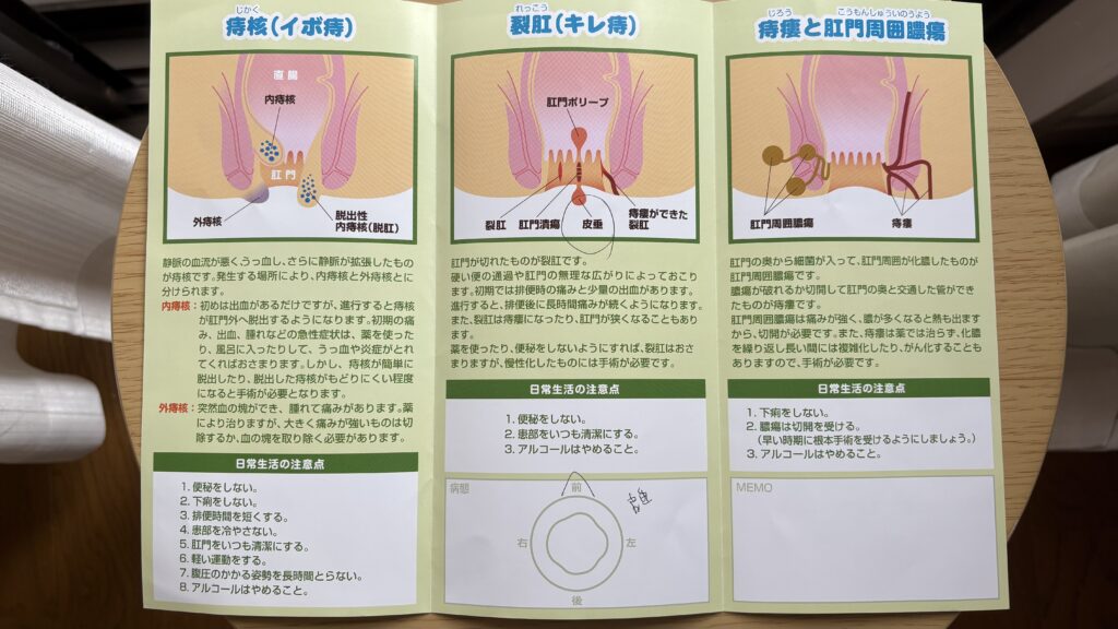 痔の種類(痔核・裂肛・痔瘻)の説明パンフレット